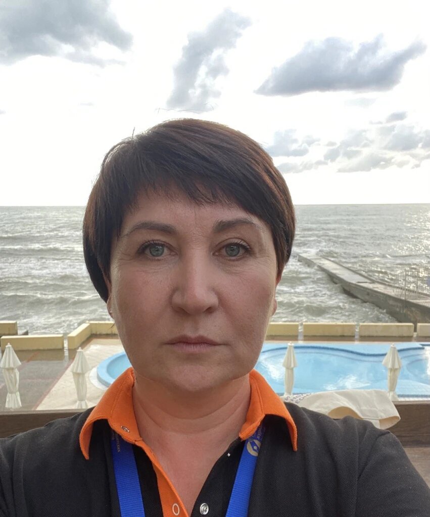 На фото Наталья ДО пластической операции.