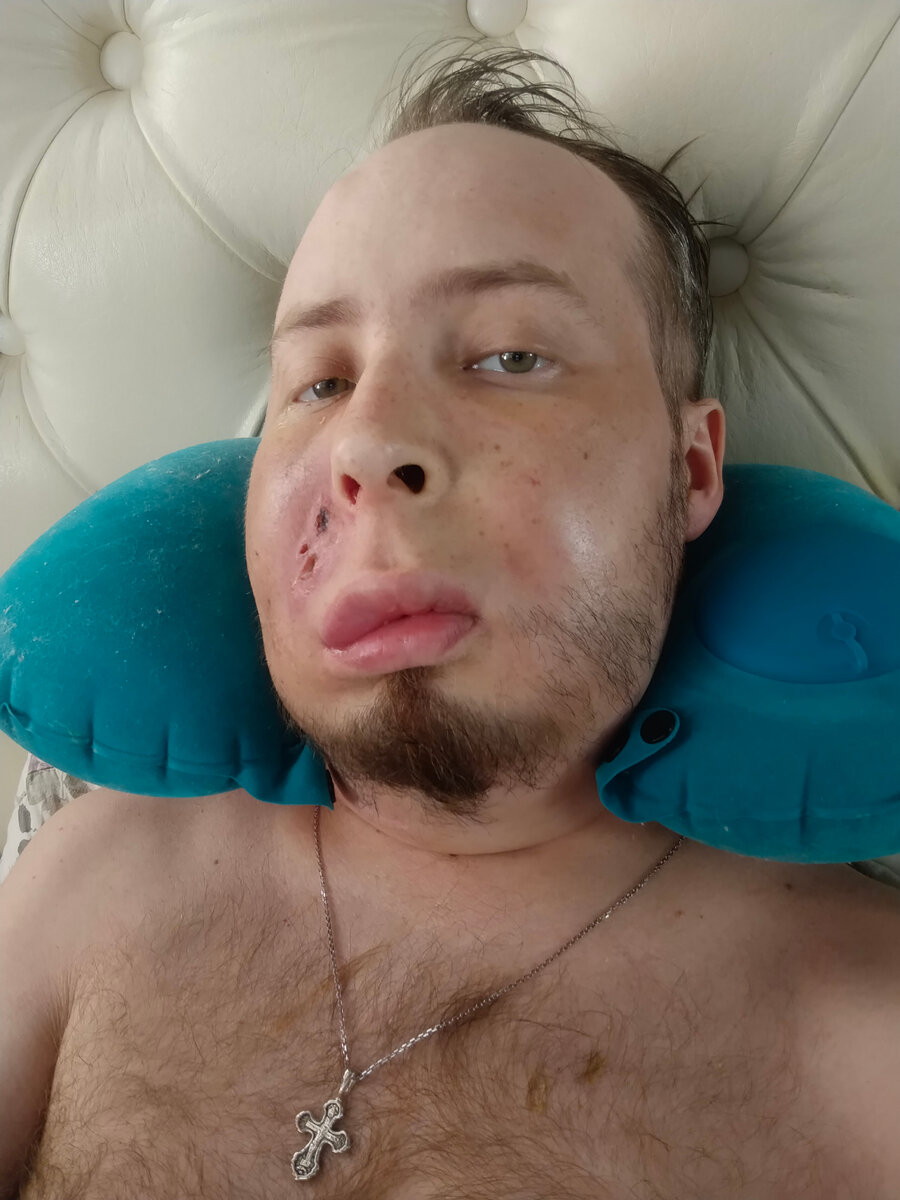 Крестик и лицо как соты