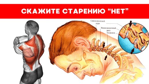 Против Холки, За ровную осанку: Лучшие упражнения для этого