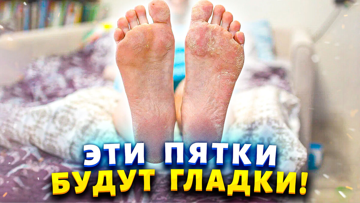 👣 Нежные пяточки: секретный рецепт домашней спа-процедуры 👣 | Марина  Жукова, Домохозяйка, Эксперт, Блогер | Дзен