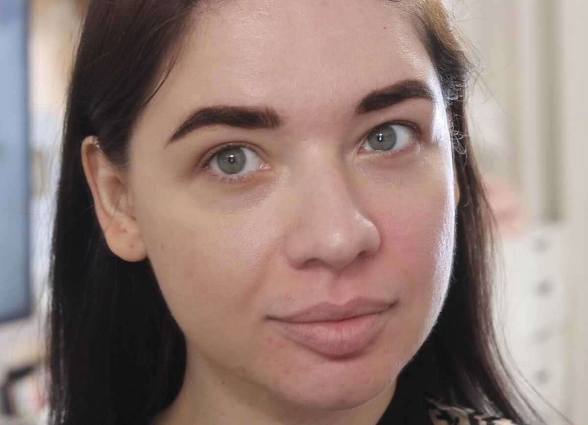 Моя кожа спустя неделю, когда я отказалась от дальнейшего тестирования продукта