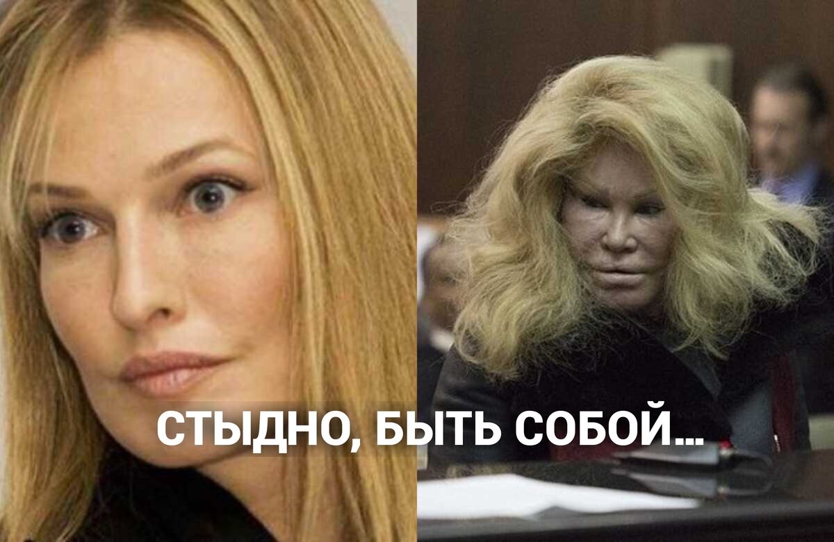 Стыд. Пластическая операция. Низкая самооценка.