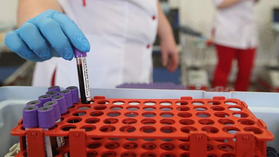 Потенциально созданная технология применима к диагностике любых болезней, связанных со значимым изменением состава биологических жидкостей