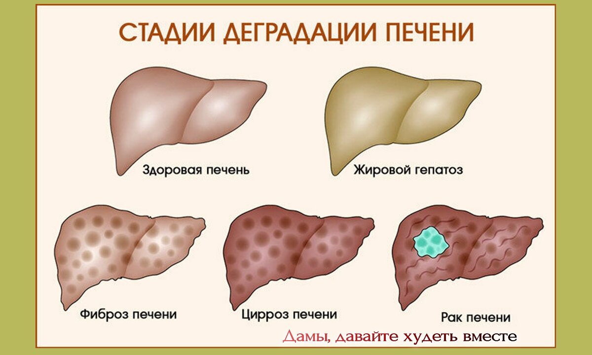 Меню для здоровья печени | Дамы, давайте худеть вместе | Дзен