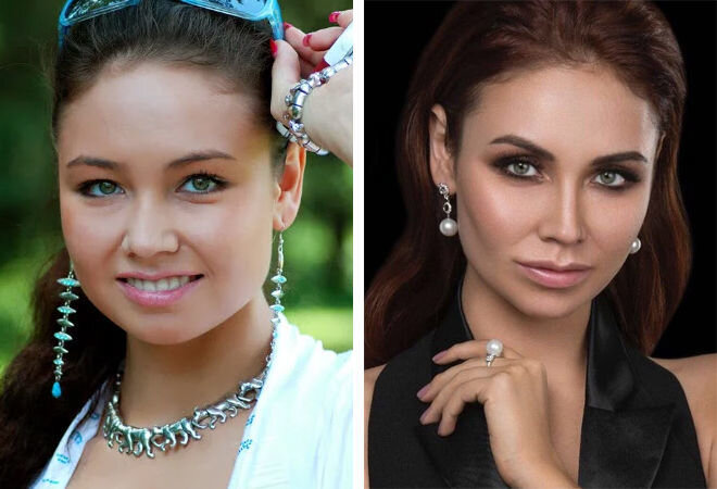 Утяшева операции. Утяшева. Ляйсан утяшева до пластики. Утяшева операции. Утяшева до пластики.