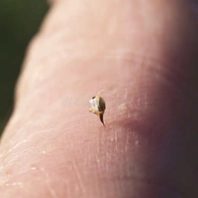 Пчелиный яд апитерапия. Как вытащить жало пчелы. Шмель пчела оса шершень укусы. Наступил на жало. Шмель пчела оса шершень укусы.