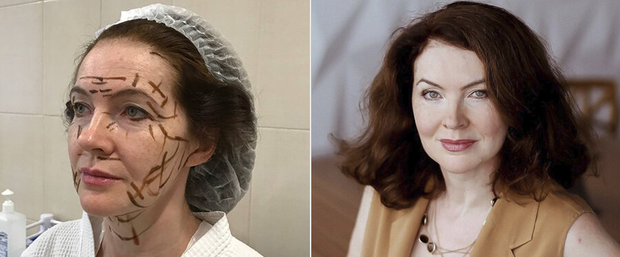 фото из личного архива пациентки