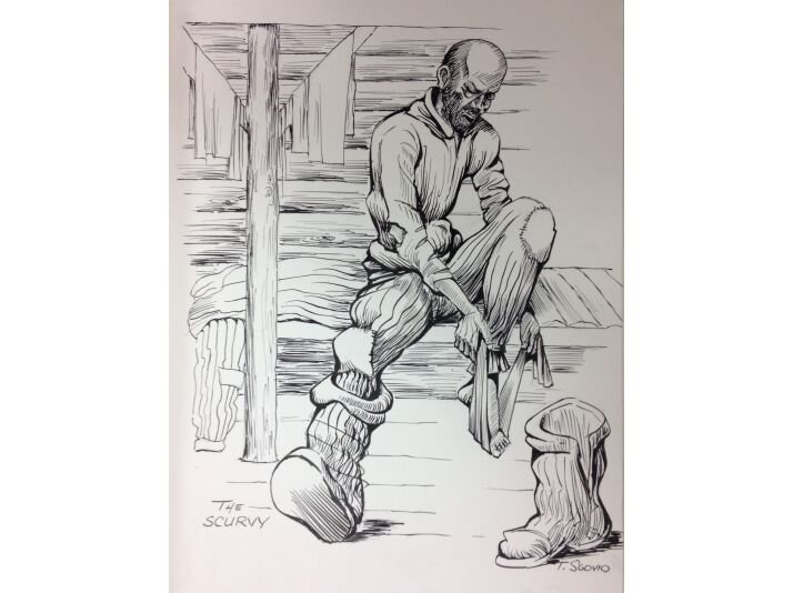 Доходяга. (Цынга)