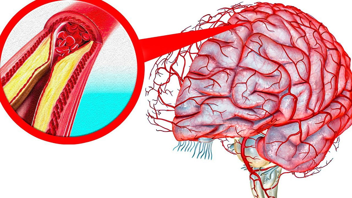 ������� �������, � ��������� ��� � ��������� �����, - ��� ��������� ��������. ����� ����, �������� ��, ��, ���� ��������� ������, � ��� � ����?-2