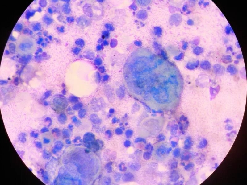 Инфекция герпеса, вид под микроскопом.