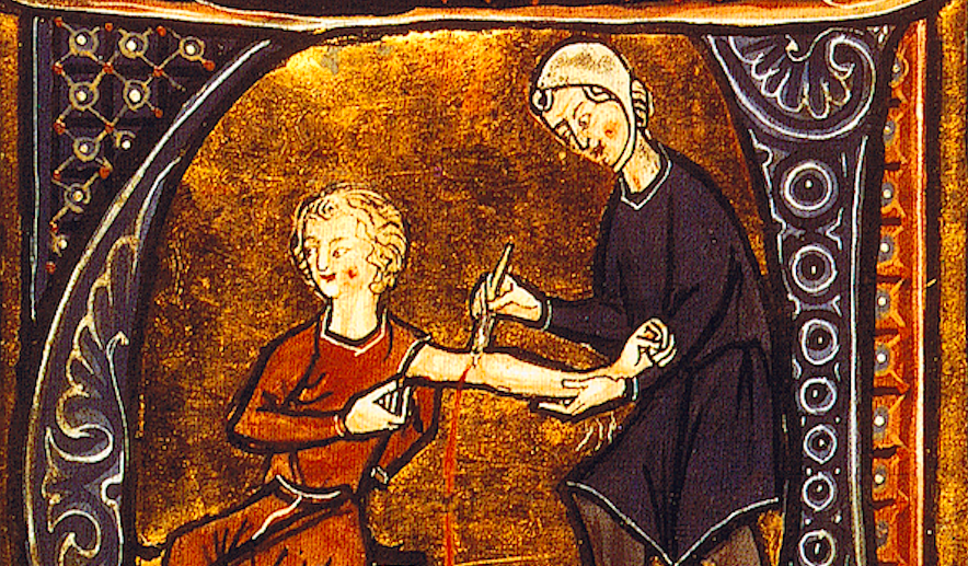 Первые упоминания о кровопускании – 3000 г. до н.э. и только в конце 19 века медики сделали вывод, что эта процедура больному скорее вредит, чем помогает.