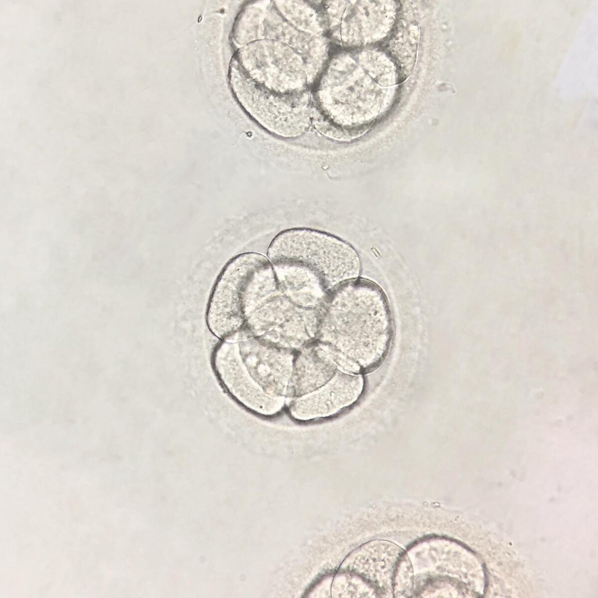 Эмбрионы человека на 3 сутки развития