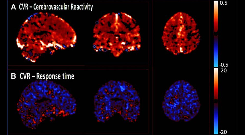   Alastair J.S. Webb et al. / Circulation Research, 2024