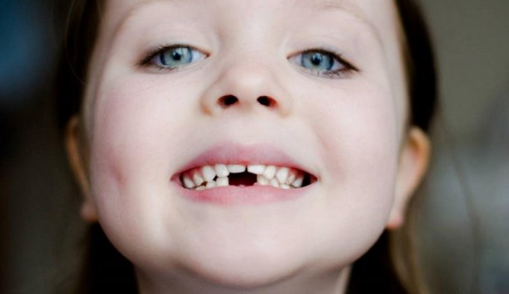 Красивая улыбка, отсутствие кариеса, нормальная работа пищеварительной системы — результат правильного прикуса. Разбираемся в статье, как современная ортодонтия может помочь ребёнку сформировать его.