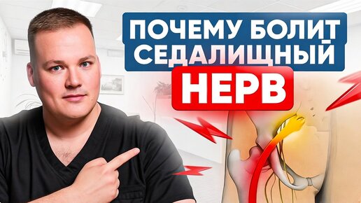 Разблокировка седалищного нерва без боли. 3 эффективных упражнения