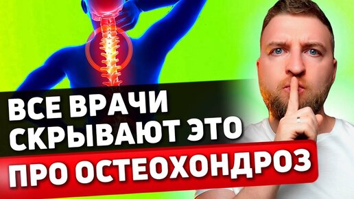 Как вылечить шейный остеохондроз без упражнений?