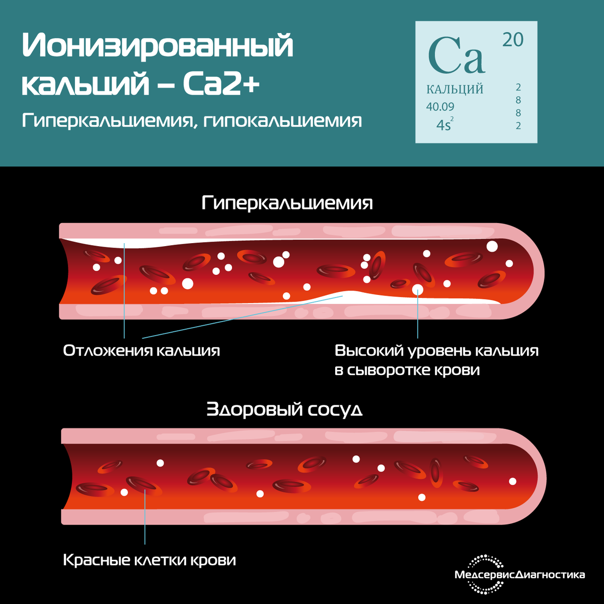 Ионизированный кальций – Ca2+. Гипокальциемия, гиперкальциемия.