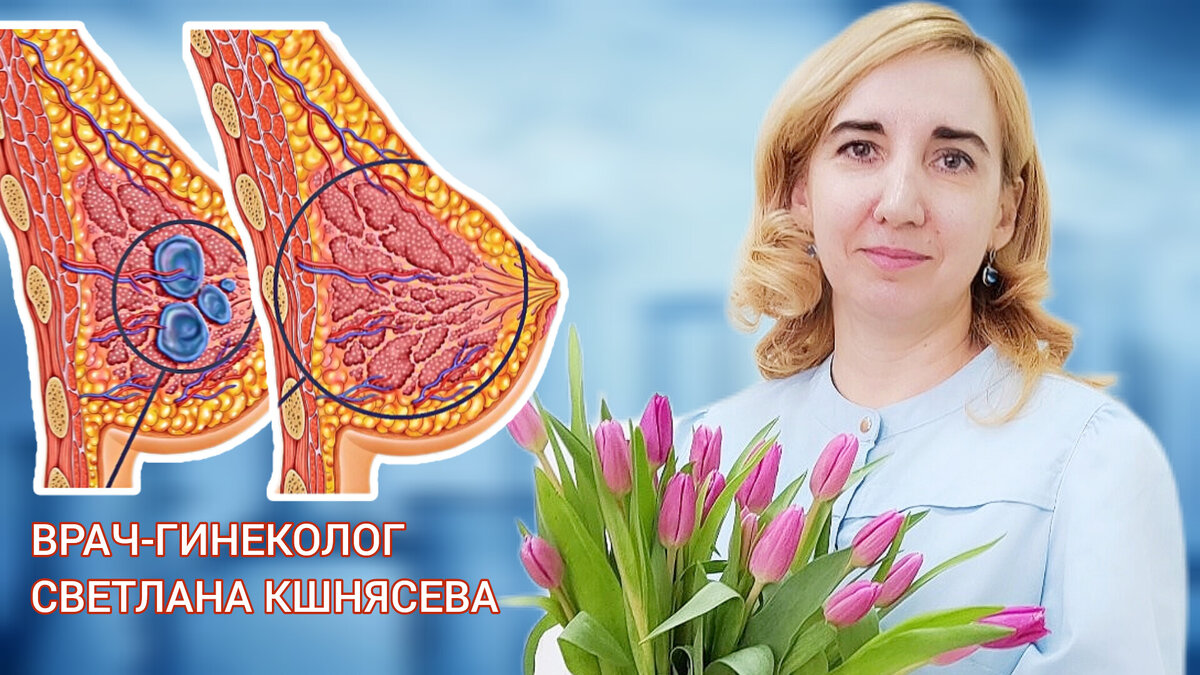 Подписчица Галина написала: «Сначала заболело в груди. Потом на обследовании выявили доброкачественную дисплазию молочной железы (диффузную мастопатию) и кисту. Что теперь будет?