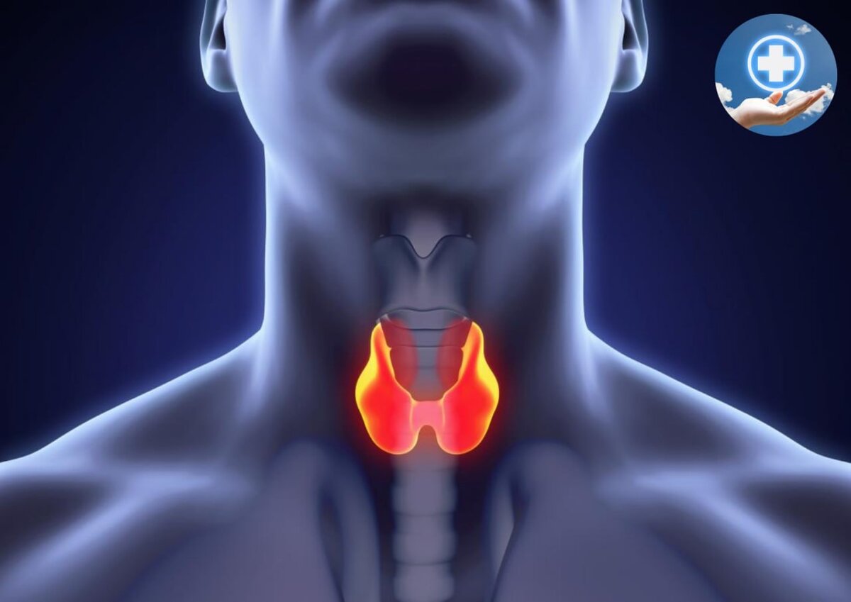 На фото представлена щитовидная железа