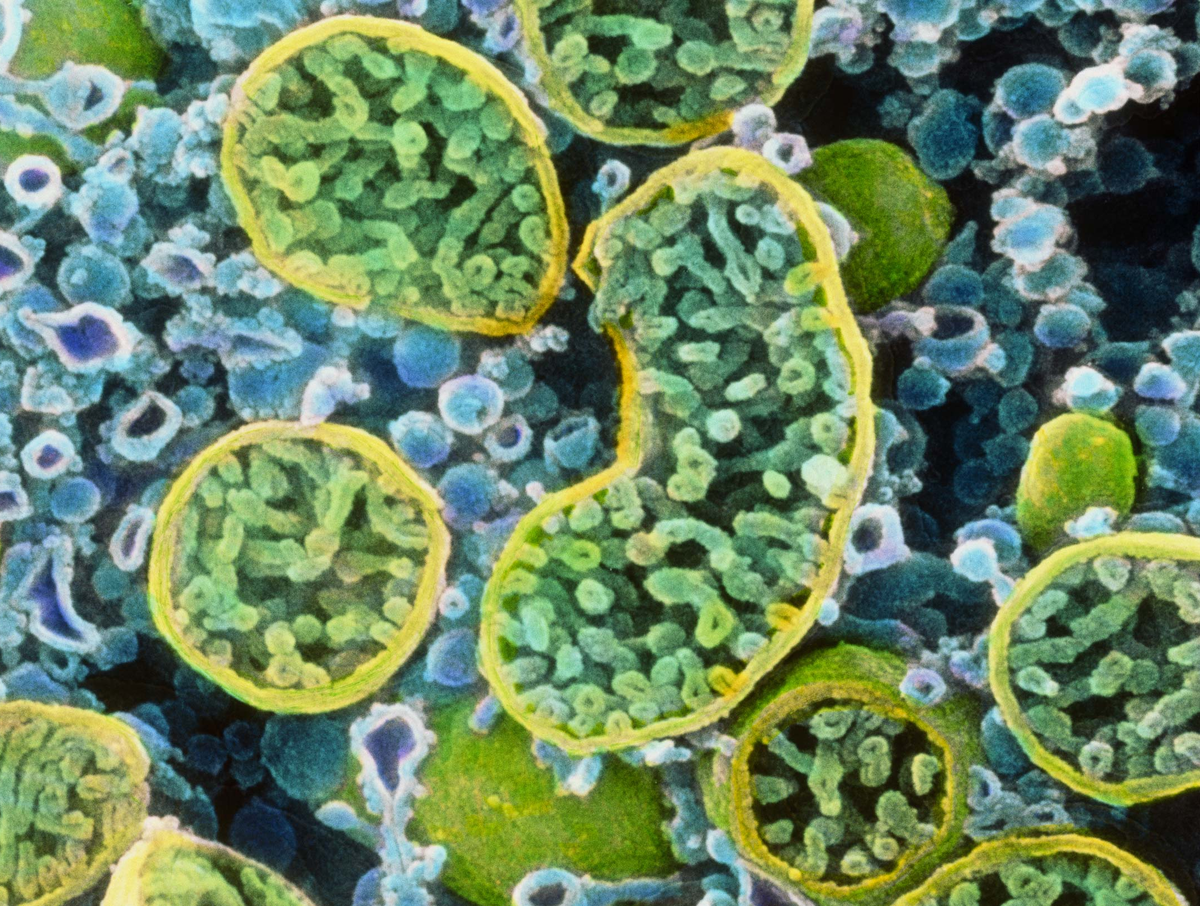 На этом рисунке митохондрии — органеллы с желтыми краями. Имеющиеся данные свидетельствуют о том, что митохондрии посылают друг другу сигналы и действуют согласованно в сети подобных. 