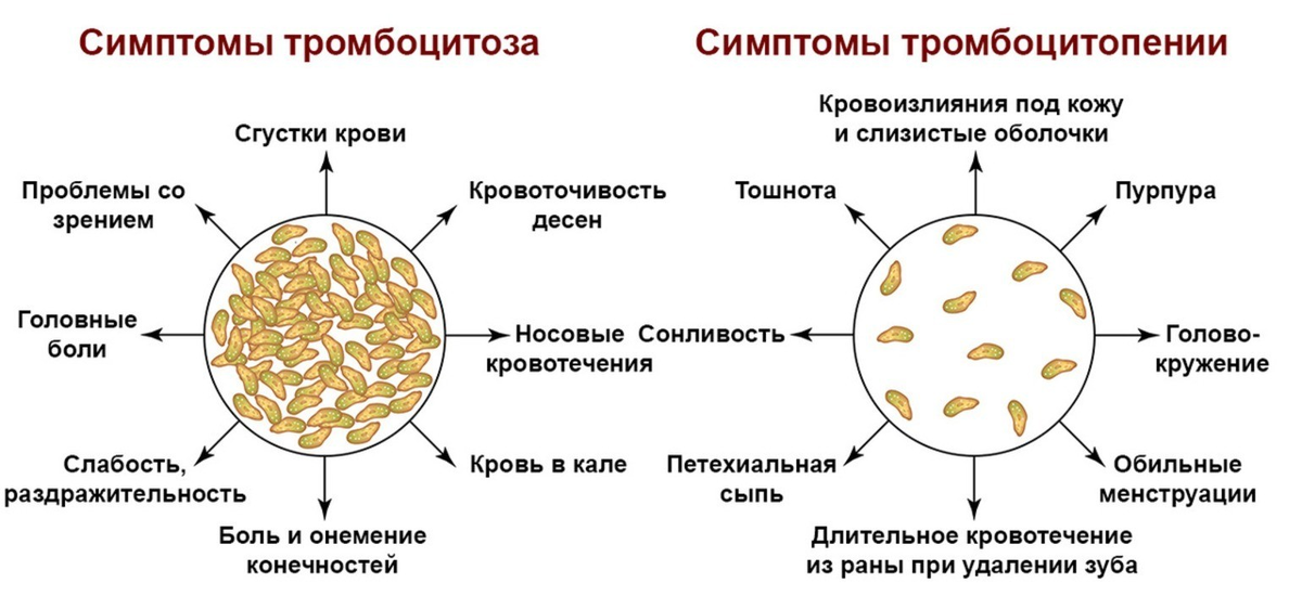 Концентрат тромбоцитов сделает суставы гибкими | Hila