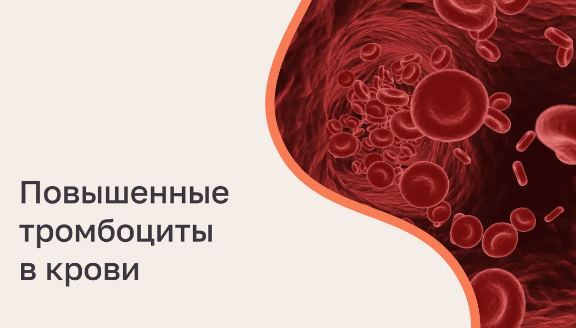 Тромбоциты в крови у женщин, мужчин и детей - норма, причины повышения и снижения