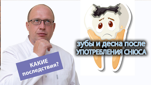 ❓ Что бывает с зубами, деснами и сердцем после употребления снюса? ❌