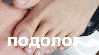 Лечение у Подолога. Процедура обрезки пожелтевших вросших ногтей на ногах. #подолог #онихогрифоз #1
