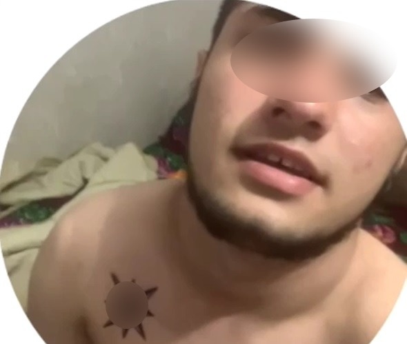    16-летний Джобиров демонстрирует экстремистские наколки и символику АУЕ (запрещённая в РФ экстремистская организация).