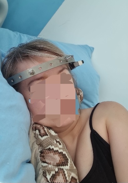 Кольцо держится на штырях ввинченых в кость черепа. Ходить с этим не больно и быстро привыкаешь к кольцу.