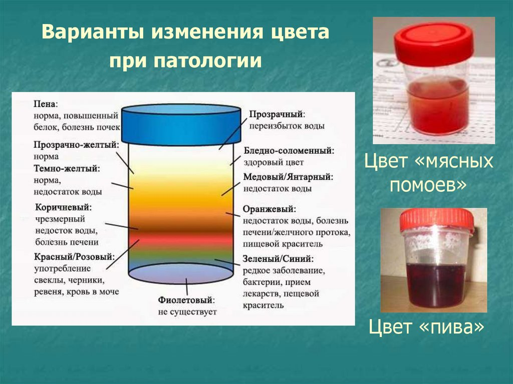 Моча красного цвета