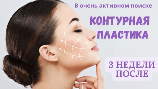 Результаты контурной пластики через 3 недели