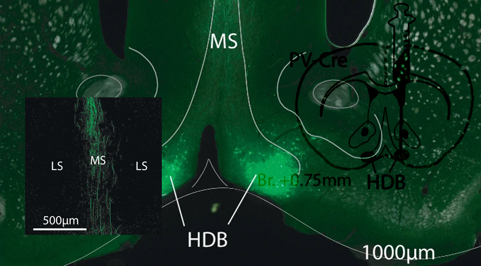   N + 1; Panna Hegedüs et al. / Nature Communications, 2024