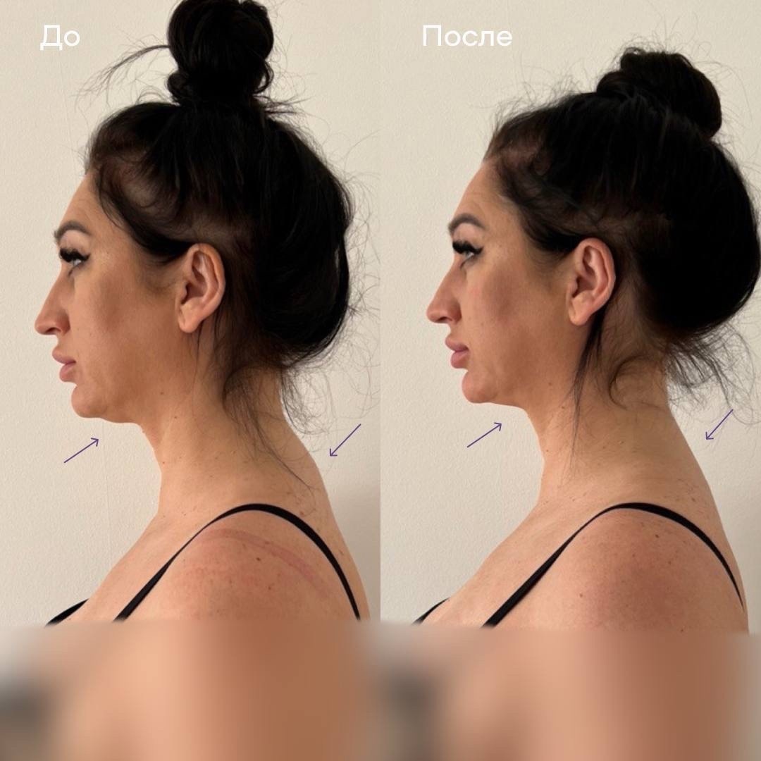 Клиника "Остео Лайт"