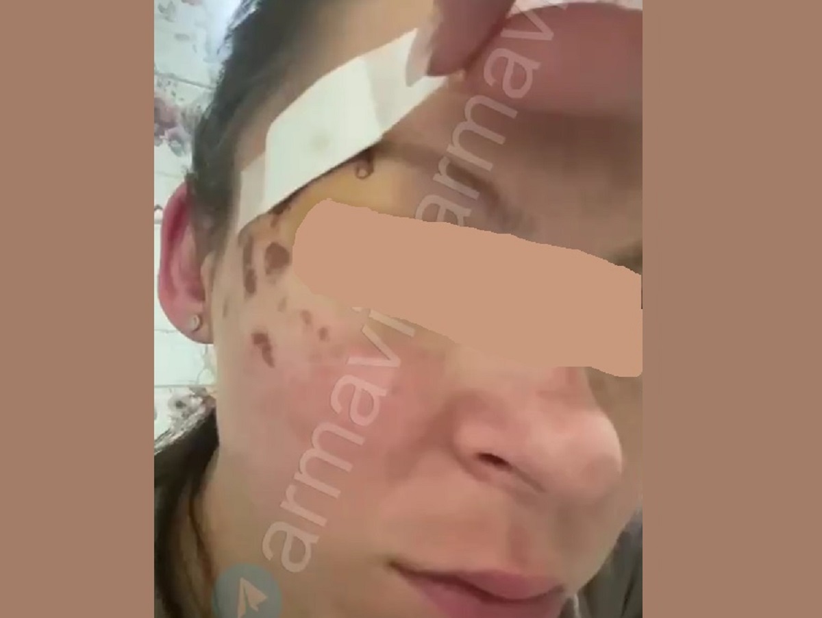 Скрин с видео: https://t.me/armavir_armavir 