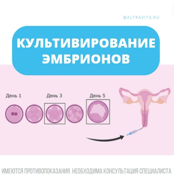 Культивирование (выращивание) эмбрионов при ЭКО