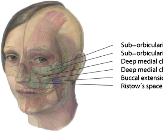 Это не оселедец, если что.