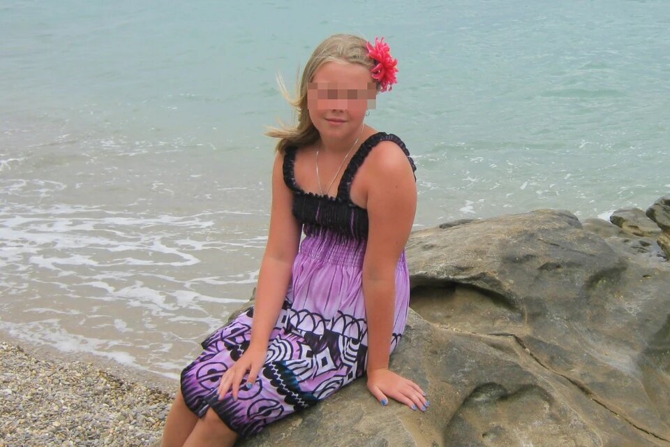 В этот день было прохладно, но девушка все равно сильно обгорела. Фото: соцсети