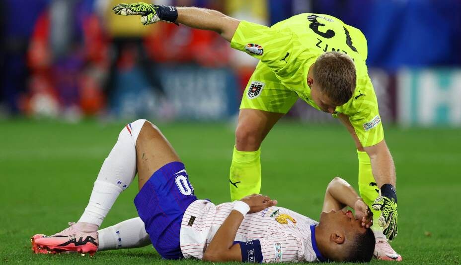    Сборная Франции осталась без своей главной звезды Килиана Мбаппе, который сломал нос. Фото: Reuters