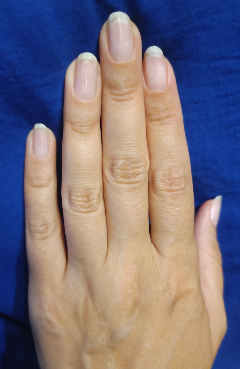 Маникюр после снятия гель-лака. 