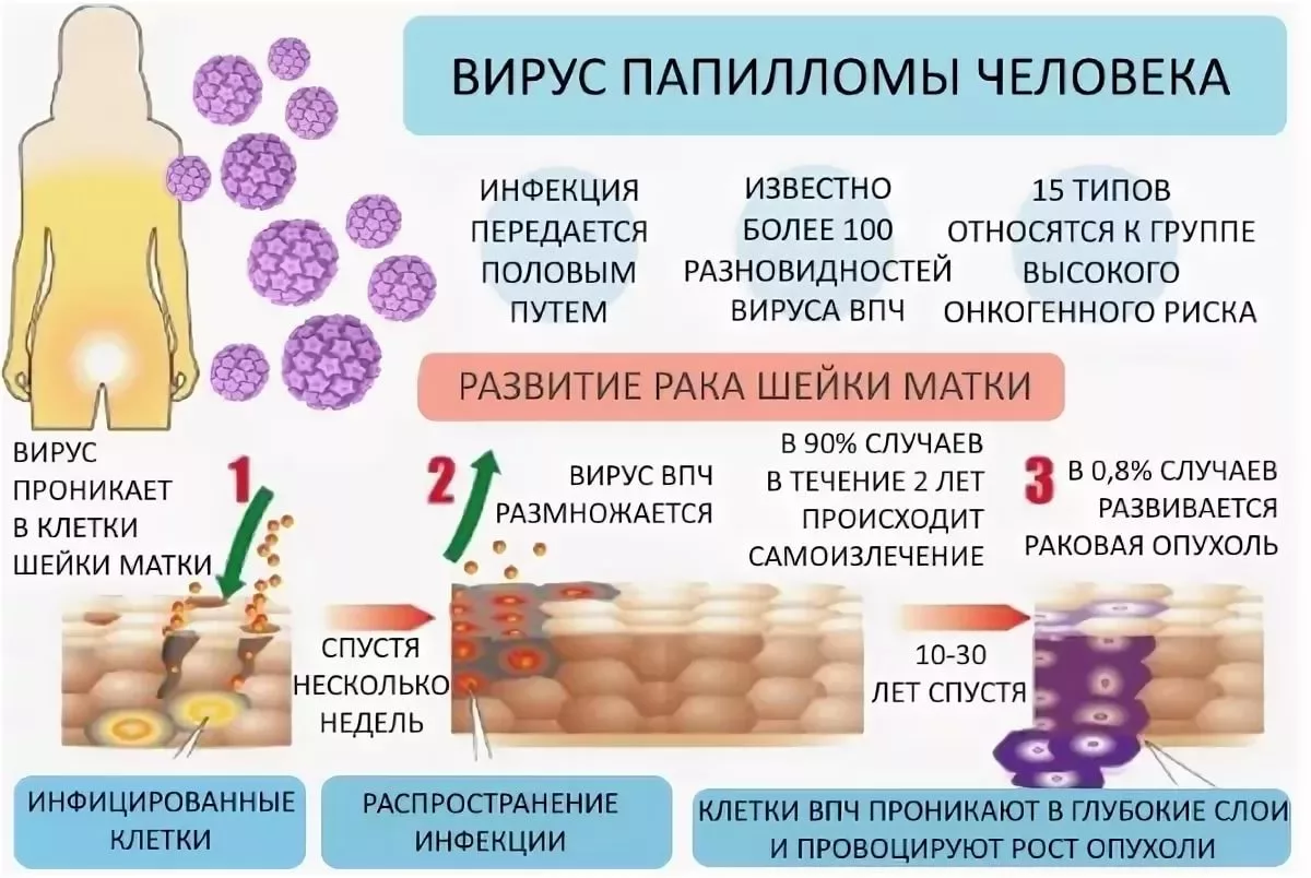 Коварный вирус, способный вызвать бородавки и рак! Что вы знаете о ВПЧ? | О  здоровье: с медицинского на русский | Дзен