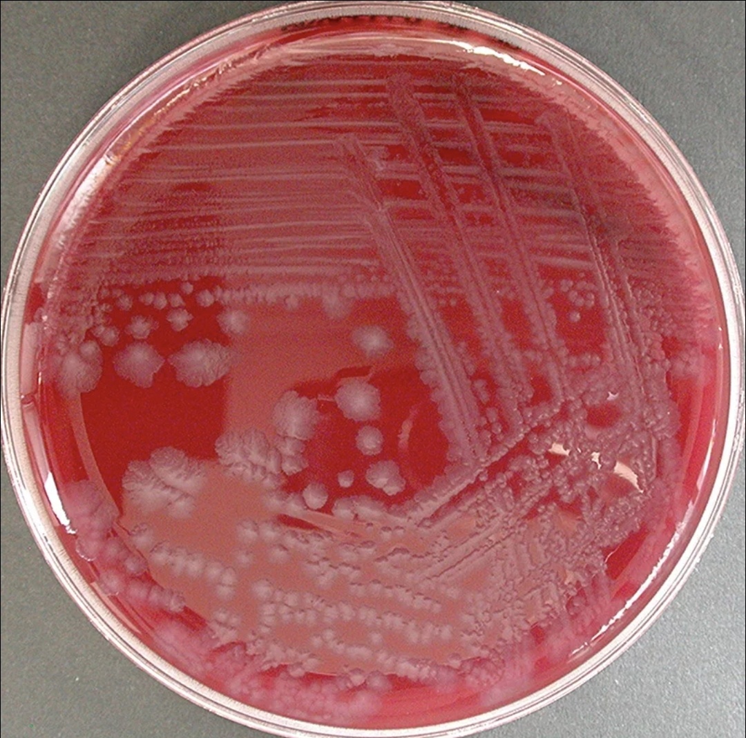 Рост C. botulinum на кровяном агаре. Фото из интернета, размещенное в свободном доступе