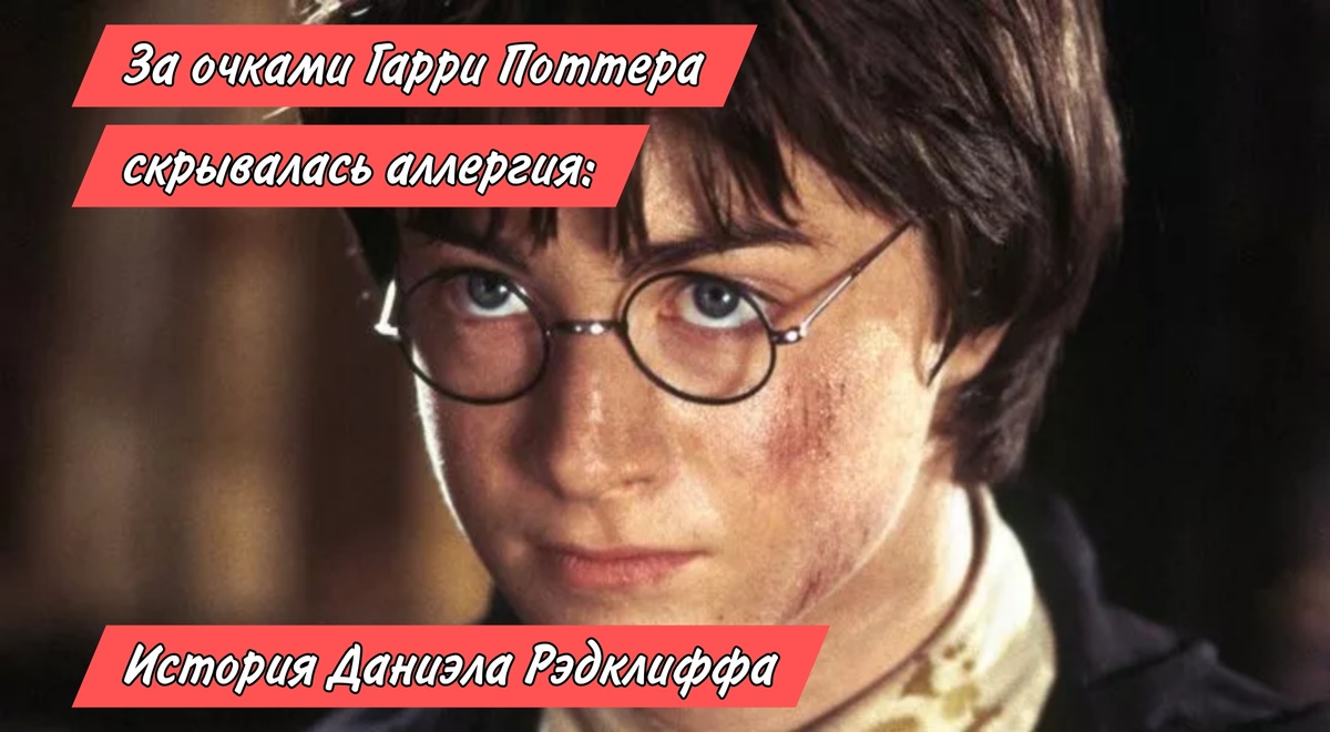 За очками Гарри Поттера скрывалась аллергия: история Даниэла Рэдклиффа