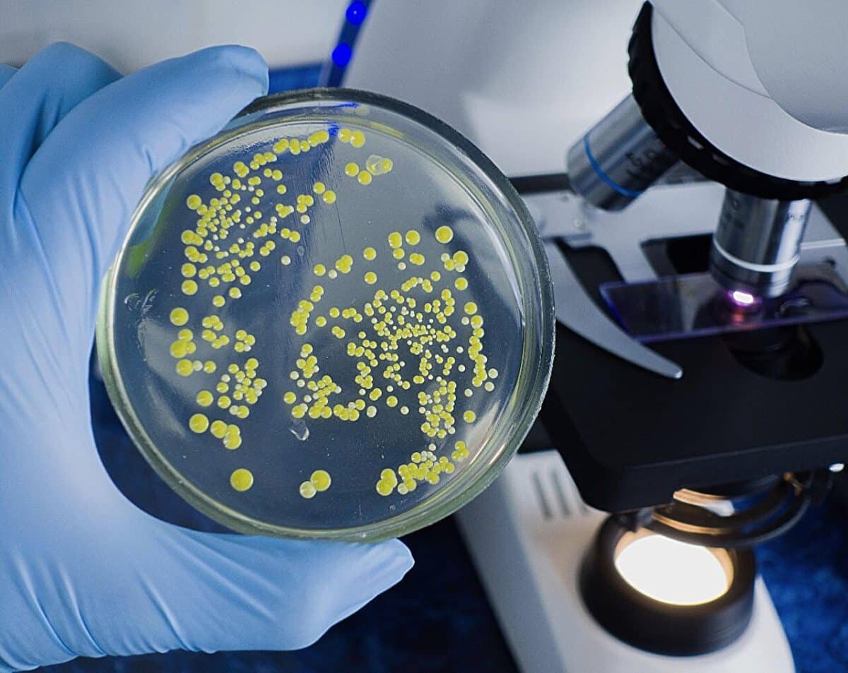    Стрептококки / © CDC