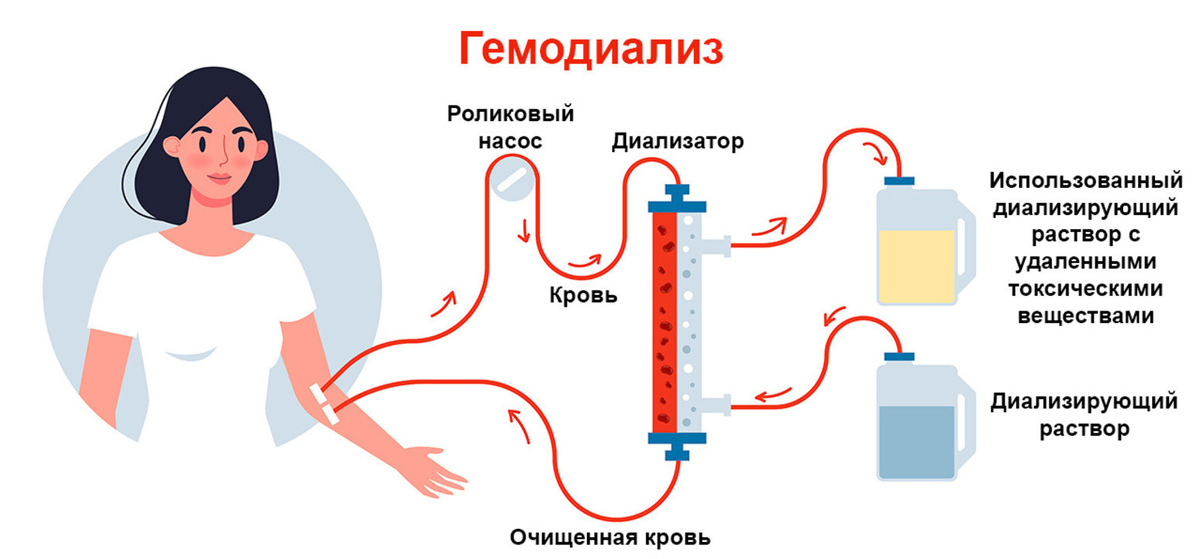 Давление при гемодиализе