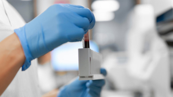    В России создали новый состав для сохранения структуры и свойств крови Роман Захаров