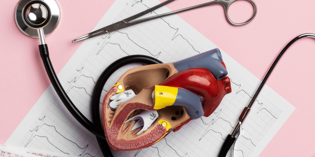 Атеросклероз: кто в группе риска?