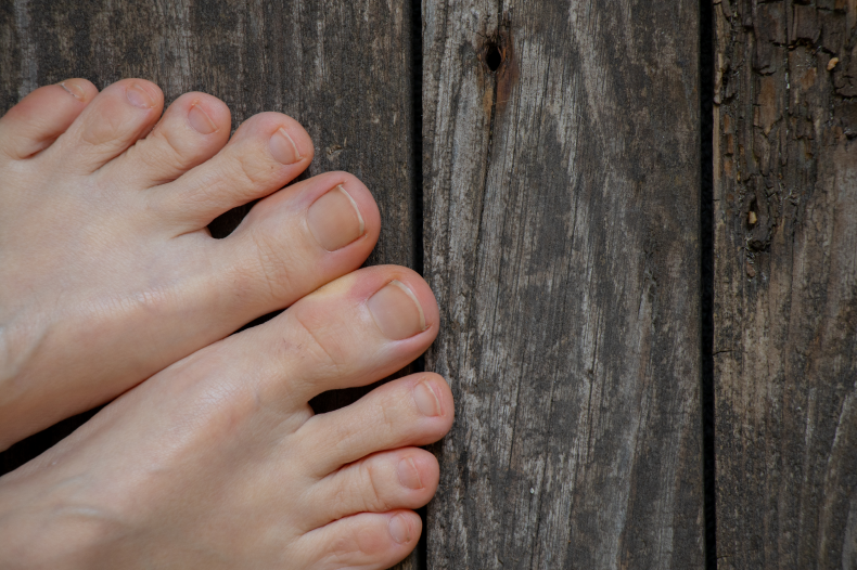 Ногти на ногах могут быть причиной не только комплексов, но и серьезных неудобств. Дискомфорт при ходьбе, боли, воспаление — все это лишь малая часть жалоб пациентов в кабинетах подологов и ортопедов.