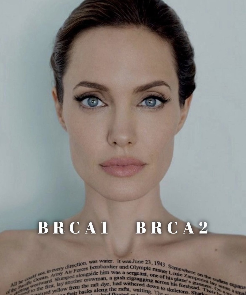 В 2013 году Анджелина Джоли удалила молочные железы, а за этим и яичники. 