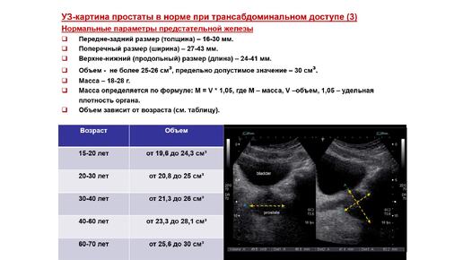 Как узнать какой размер члена: Смотрете порно онлайн